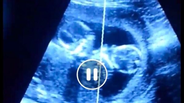 Medical Expenses for John Ryman’s Twins - – Sadik-O
