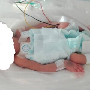 Help a Little Baby Girl Survive - – Sadik-O