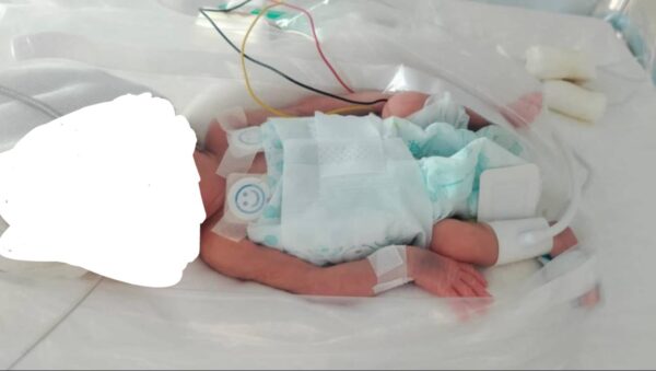 Help a Little Baby Girl Survive - – Sadik-O