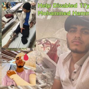 Help Disabled 18yo Mohammed Hammad survive! - – Sadik-O