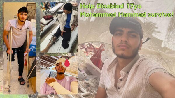 Help Disabled 18yo Mohammed Hammad survive! - – Sadik-O