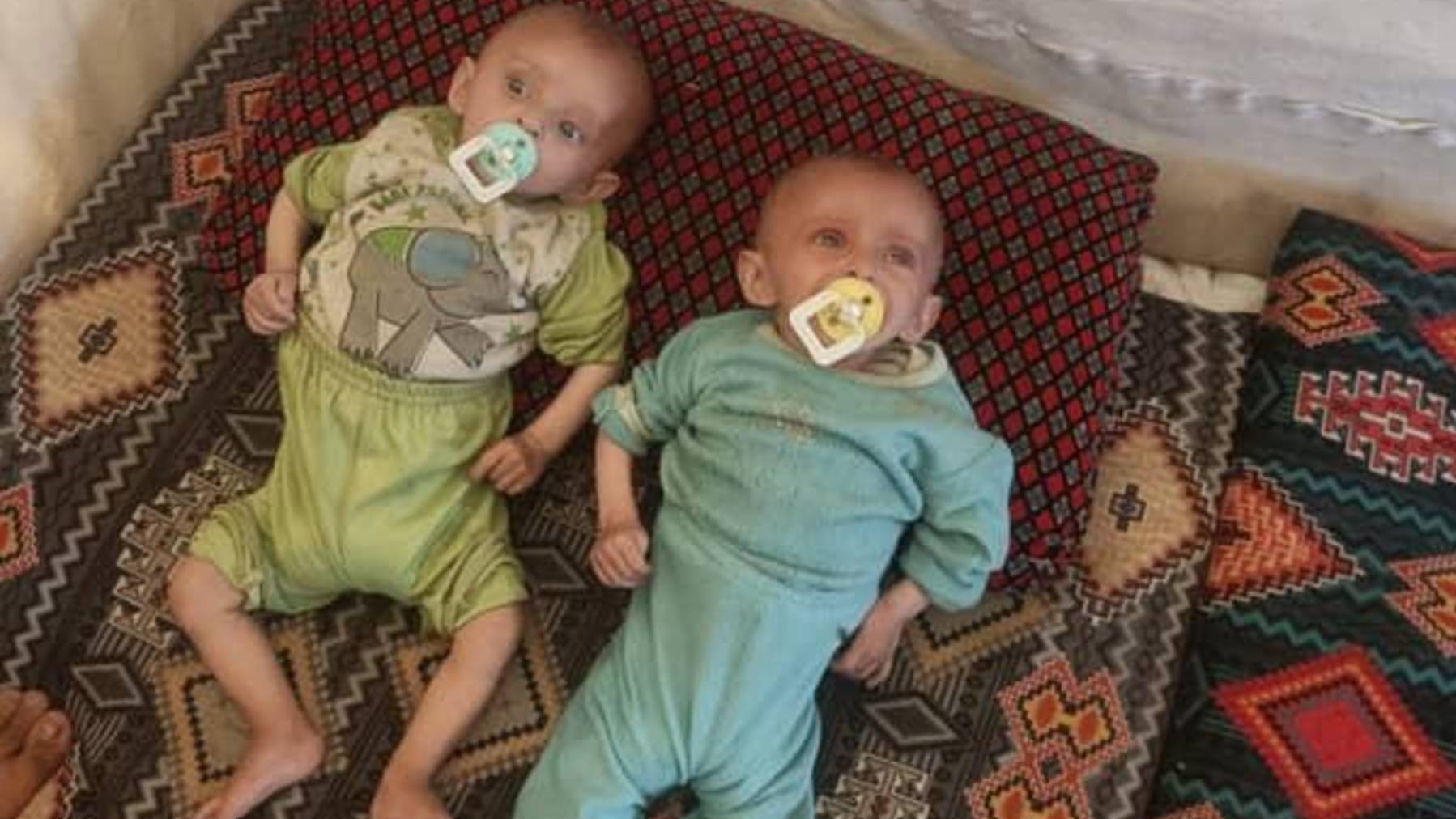https://sadik-o.com - refugees and asylum seeekers - SUPPORT SURVIVING TWIN BOSHRA TO SURVIVE