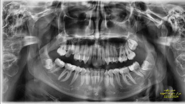 Urgent help : Help Mona with her dental treatment - – Sadik-O