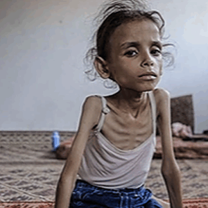 https://sadik-o.com - refugees and asylum seeekers - Help Save Maryam–Emergency Support for Malnourished Child in Gaza