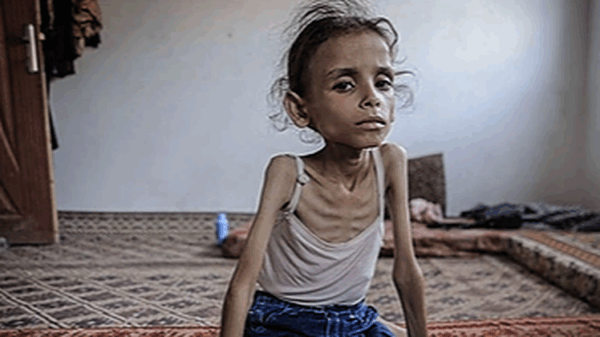 https://sadik-o.com - refugees and asylum seeekers - Help Save Maryam–Emergency Support for Malnourished Child in Gaza