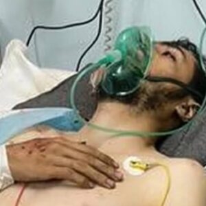 https://sadik-o.com - refugees and asylum seeekers - Help Nurse Ali Khader Survive His Injuries