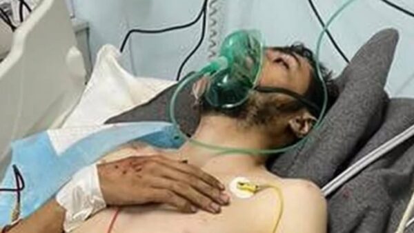 https://sadik-o.com - refugees and asylum seeekers - Help Nurse Ali Khader Survive His Injuries
