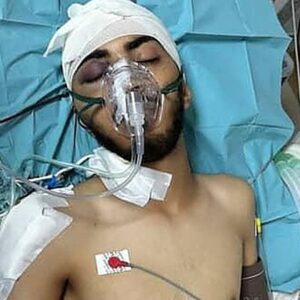Help Amer get treatment abroad after being shot in his head - – Sadik-O
