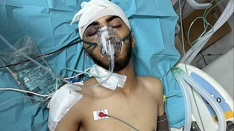 Help Amer get treatment abroad after being shot in his head - – Sadik-O