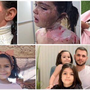 URGENT: Help Shahd Al-Baz Receive Burn Treatment Abroad - – Sadik-O