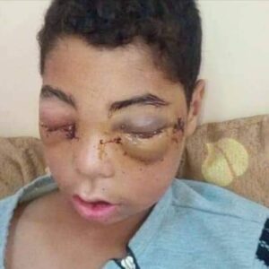 https://sadik-o.com - refugees and asylum seeekers - Help Abdulkarim recover from his injuries