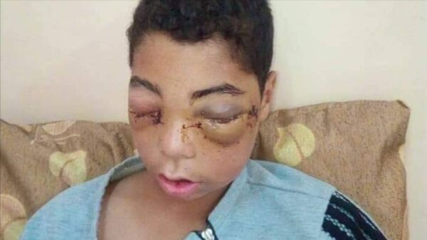 https://sadik-o.com - refugees and asylum seeekers - Help Abdulkarim recover from his injuries