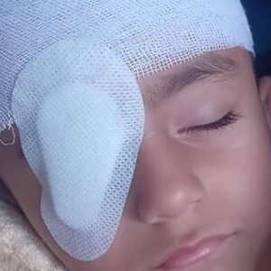 Help Omar receive surgery for his eye nerve transplant - – Sadik-O