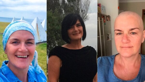 Keren's Bilateral Mastectomy and Reconstruction - – Sadik-O