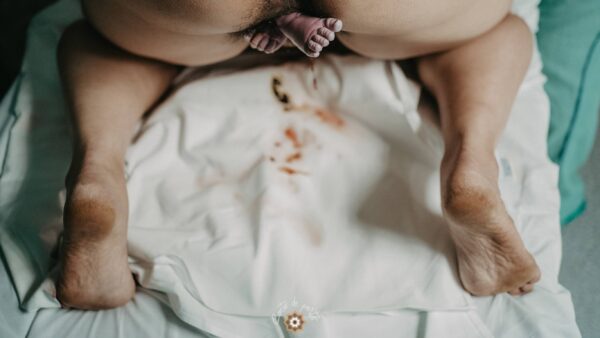Globalize Breech Birth - – Sadik-O
