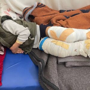 https://sadik-o.com - refugees and asylum seeekers - Campaign for Qasim to correct his club feet