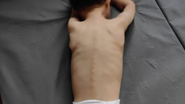 Urgent: Help Save Muhammad