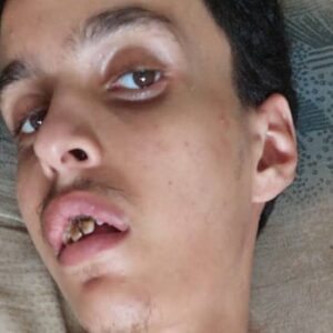 Emergency Support for Osama Nabil Hassan Dahman - – Sadik-O