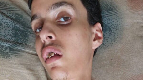 Emergency Support for Osama Nabil Hassan Dahman - – Sadik-O