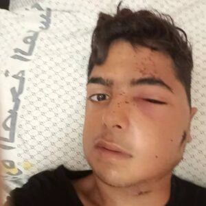Support Jihad With His Recovery
