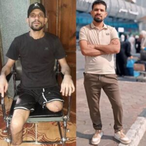 Help Sayed afford prosthetic legs after tragic accident - – Sadik-O