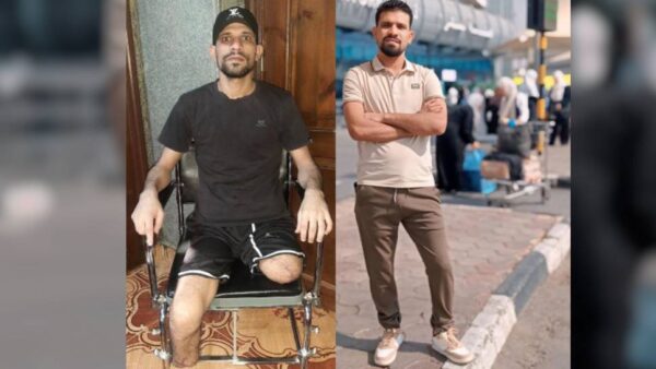 Help Sayed afford prosthetic legs after tragic accident - – Sadik-O