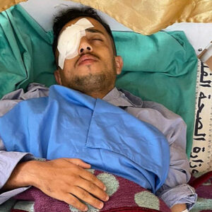 Cornea Transplant for Aboud - – Sadik-O