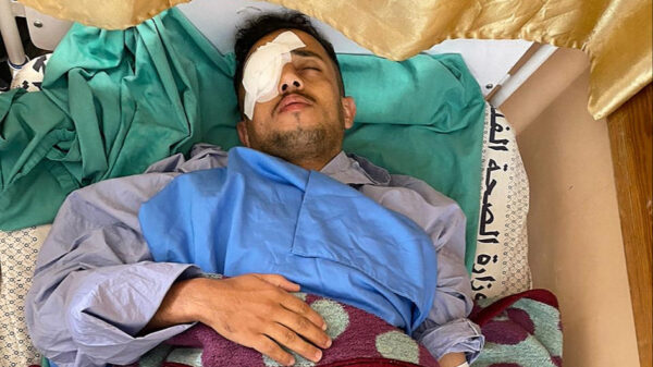 Cornea Transplant for Aboud - – Sadik-O