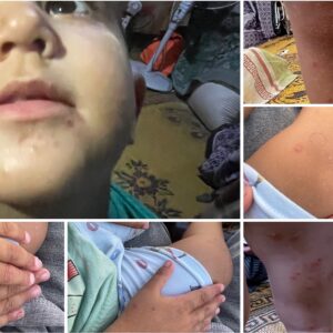 "Medical treatment for child Salah in Gaza" - – Sadik-O