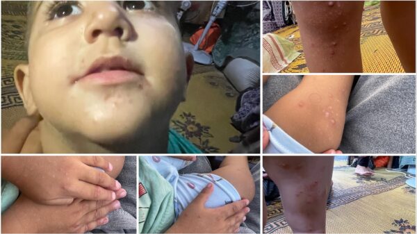 "Medical treatment for child Salah in Gaza" - – Sadik-O