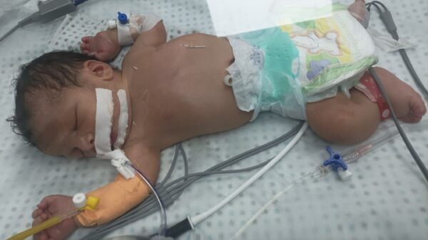 Baby Jannah Needs Urgent Heart Surgery - – Sadik-O