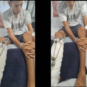 Support Ahmed With His Medical Treatment After His Amputation and His Family's Daily Needs - – Sadik-O