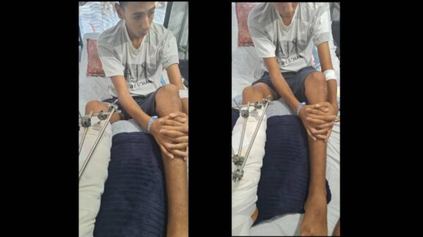 Support Ahmed With His Medical Treatment After His Amputation and His Family's Daily Needs - – Sadik-O
