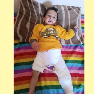 https://sadik-o.com - refugees and asylum seeekers - Help Little Tahseen and Batoul Rebuild their Lives in Gaza