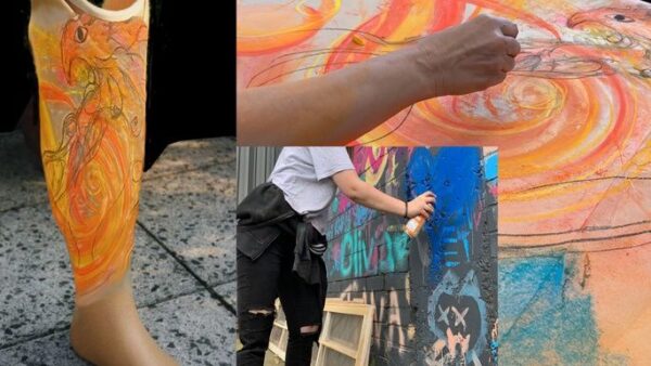 "ART-i-ficial Limb Projekt" - Paediatric Prosthetic Program - – Sadik-O