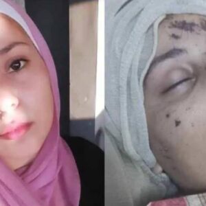 https://sadik-o.com - refugees and asylum seeekers - Asmaa’s Fight to Survive: Injured