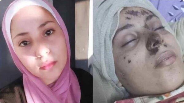 https://sadik-o.com - refugees and asylum seeekers - Asmaa’s Fight to Survive: Injured