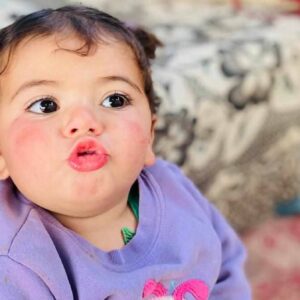 Palestinian Baby Malak in Gaza - official Smallpox medical emergency - – Sadik-O