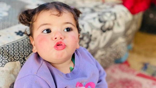 Palestinian Baby Malak in Gaza - official Smallpox medical emergency - – Sadik-O