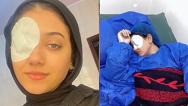 Help Restore the light to Dima’s Eye - – Sadik-O