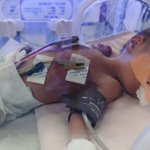 Diapers and medicine for baby Wesam Nael Al- Baha - – Sadik-O