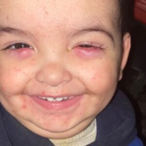 https://sadik-o.com - refugees and asylum seeekers - Medical Treatment for Mohammed