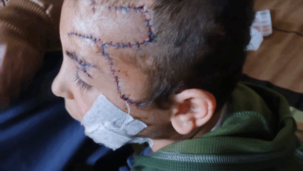Discover trusted medical crowdfunding campaigns on Sadik-O. Raise funds for urgent surgeries
