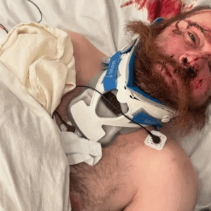Support medical crowdfunding campaigns for urgent treatments