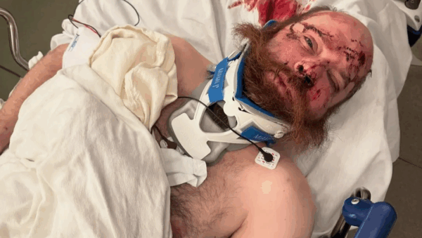 Support medical crowdfunding campaigns for urgent treatments