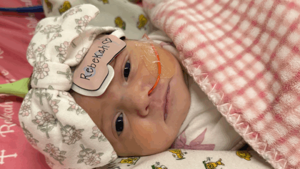 Open Heart Surgery -  Rebekah Hope Richardson