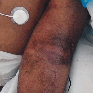 Discover trusted medical crowdfunding campaigns on Sadik-O. Raise funds for urgent surgeries