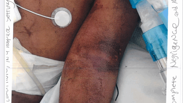 Discover trusted medical crowdfunding campaigns on Sadik-O. Raise funds for urgent surgeries