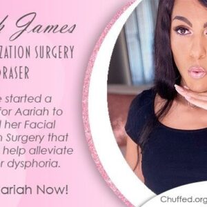 Aariah’s Facial Feminization Surgery - – Sadik-O