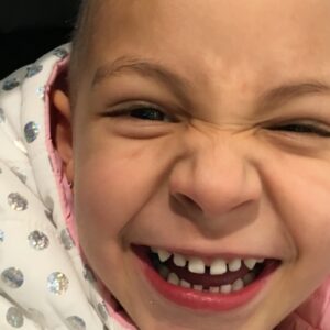 Genique's brain surgery - – Sadik-O
